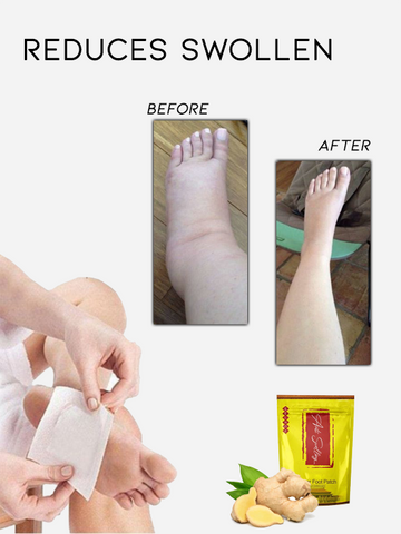anti swelling ginger detoxing patch 1