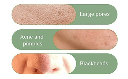 Cleansing Facial Mask Stick For All Skin Types (Women & Men)