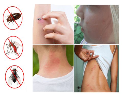 mosquito flies killer trap 11 1