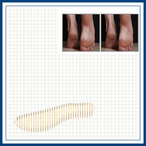 women orthopedic hollow carved diabetic walking sandals 27 1